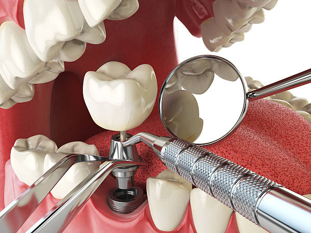 Best Weekend Emergency Dentist in Carleton, MI